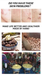 ABC African Black Soap – Deep Cleaning & Whitening - Image 5